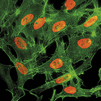 H3K14ac Antibody validated in Immunofluorescence