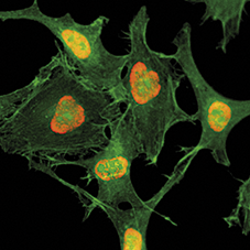 H3K79ac Antibody validated in Immunofluorescence