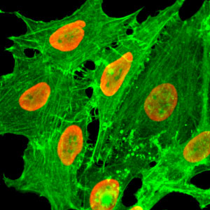 H2BK20ac Antibody validated in Immunofluorescence 