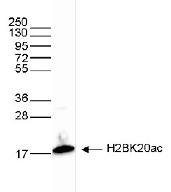 H2BK20ac Antibody validated in Western Blot