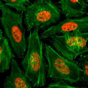 H3K4me1 Antibody validated in Immunofluorescence