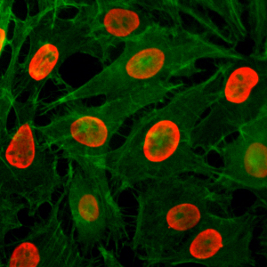 H3K9ac Antibody validated in Immunofluorescence