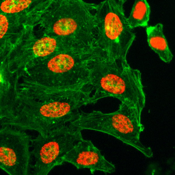 H3K18ac Antibody validated in Immunofluorescence