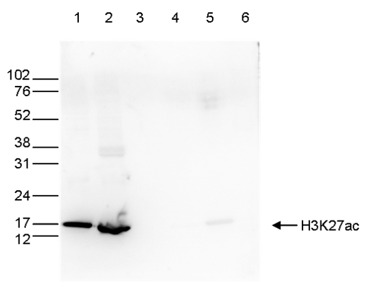 H3K27ac Antibody for Western Blot