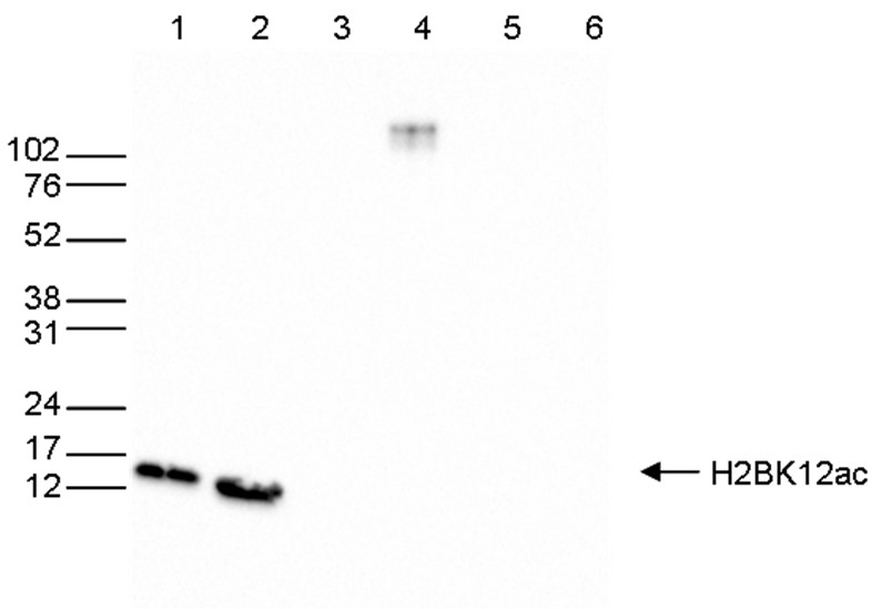 H2BK12ac Antibody validated in Western Blot