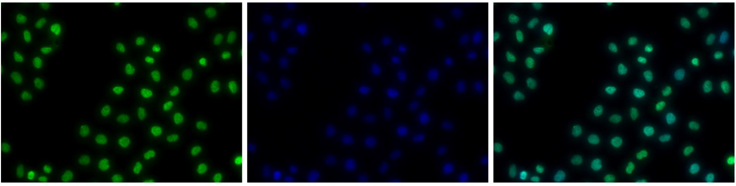 H2BK15ac Antibody validated in Immunofluorescence