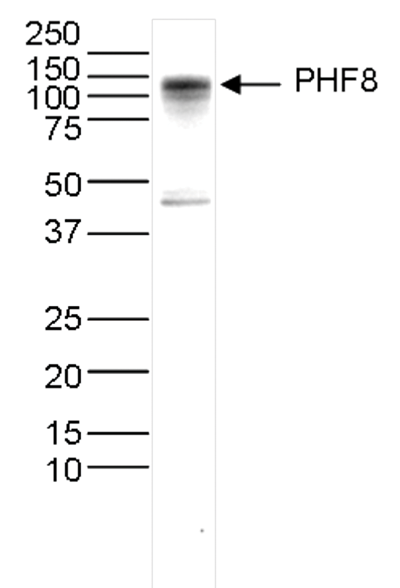 PHF8 Antibody validated in Western Blot